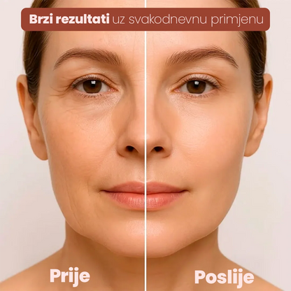 Kupi 1 i uzmi 2 – Intenzivna hidratacija - LUNA GLOW